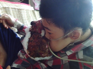 Cùng chung tay Cầu Nhân Ái